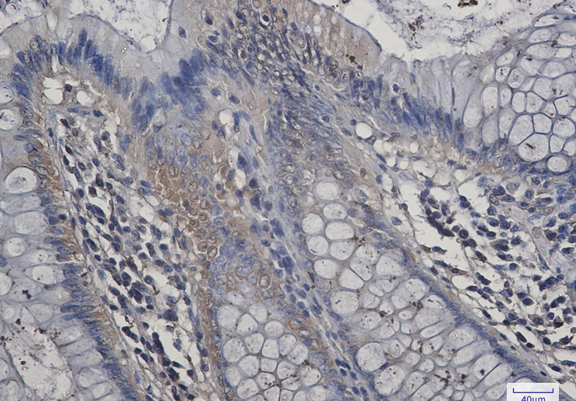 Aspartate Aminotransferase Rabbit Monoclonal Antibody