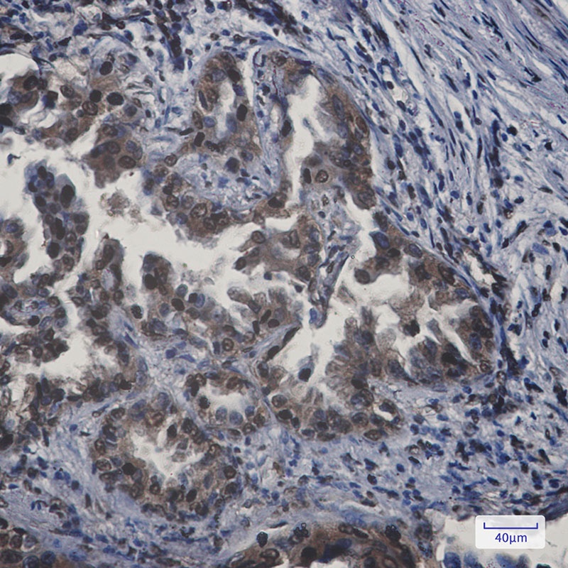 APPL Rabbit Monoclonal Antibody