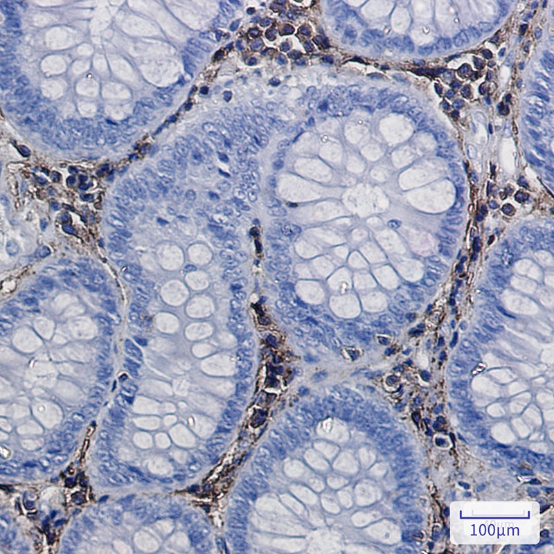 ANXA6 Antibody