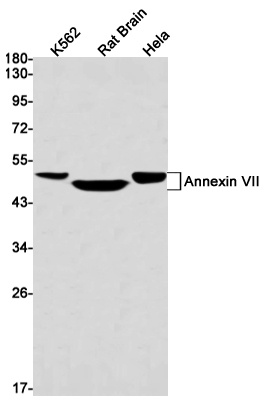 ANXA7 Antibody
