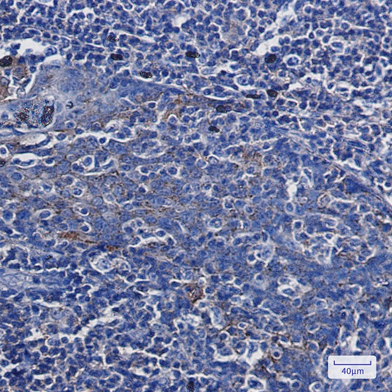 ANXA7 Antibody