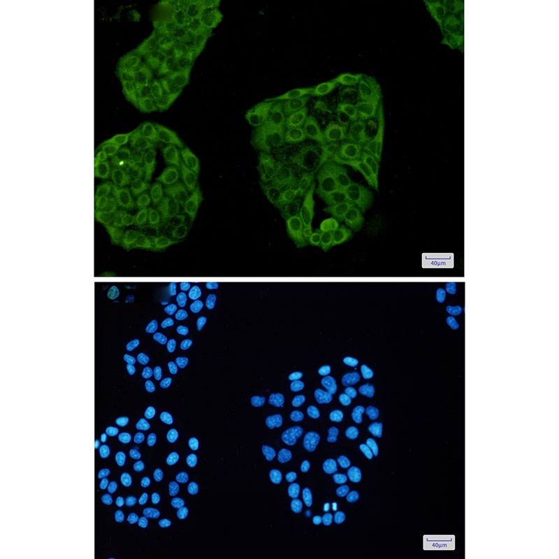 ANXA6 Antibody