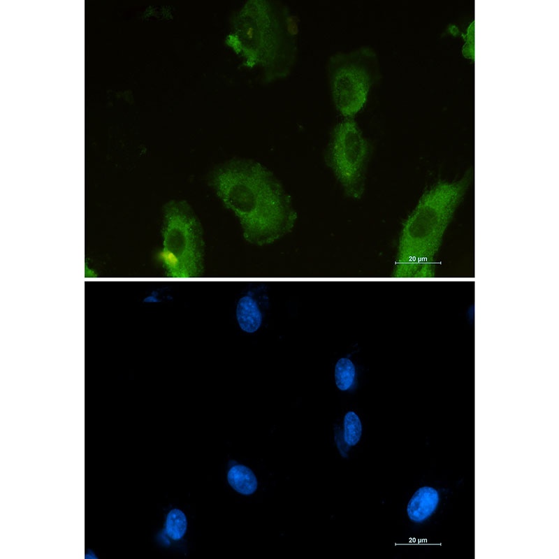 ALDOA Antibody