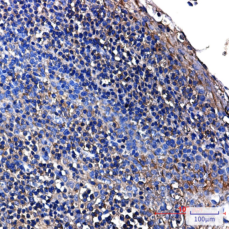 ALDOA Antibody
