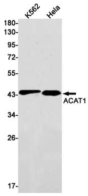 ACAT1 Antibody