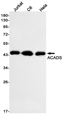 ACADS Antibody
