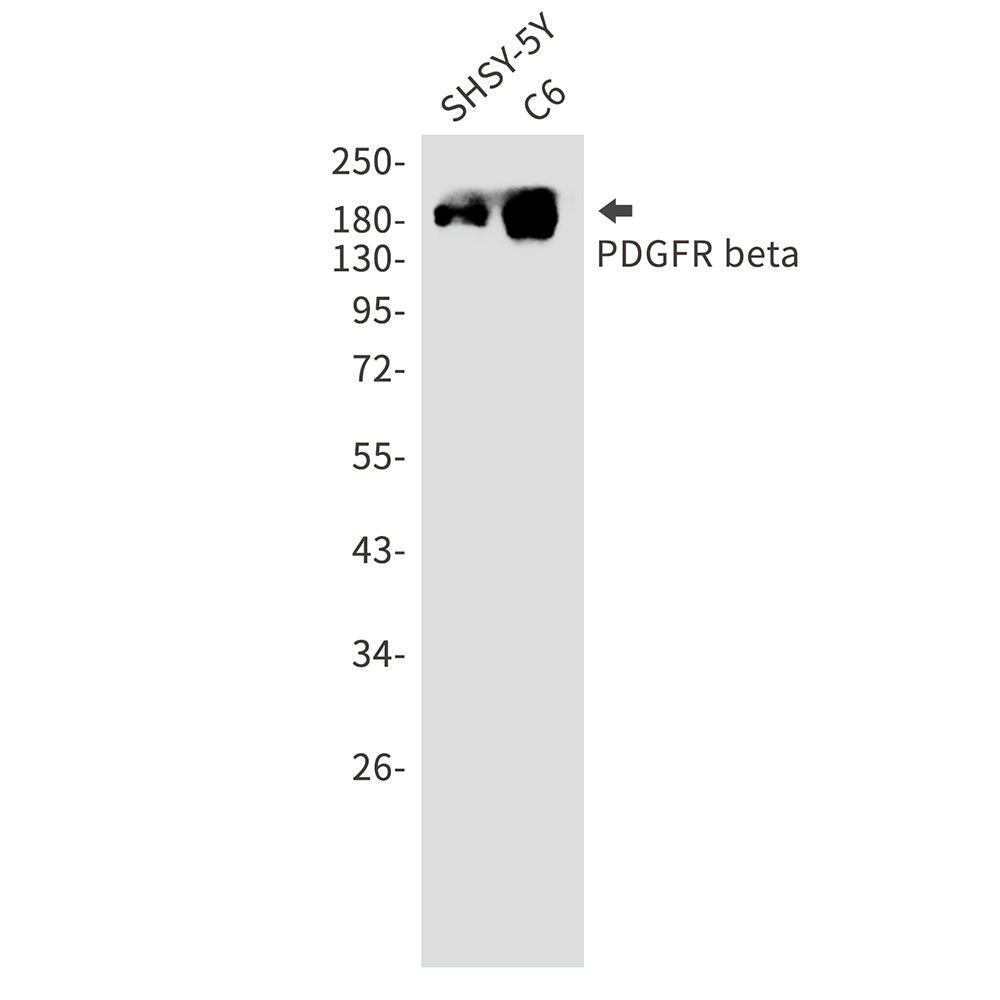 PDGFRB Antibody