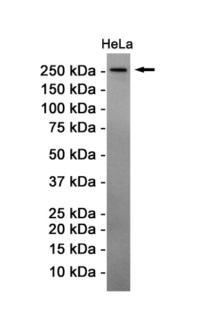ATM Antibody