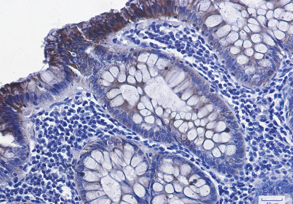 GSK3B Antibody