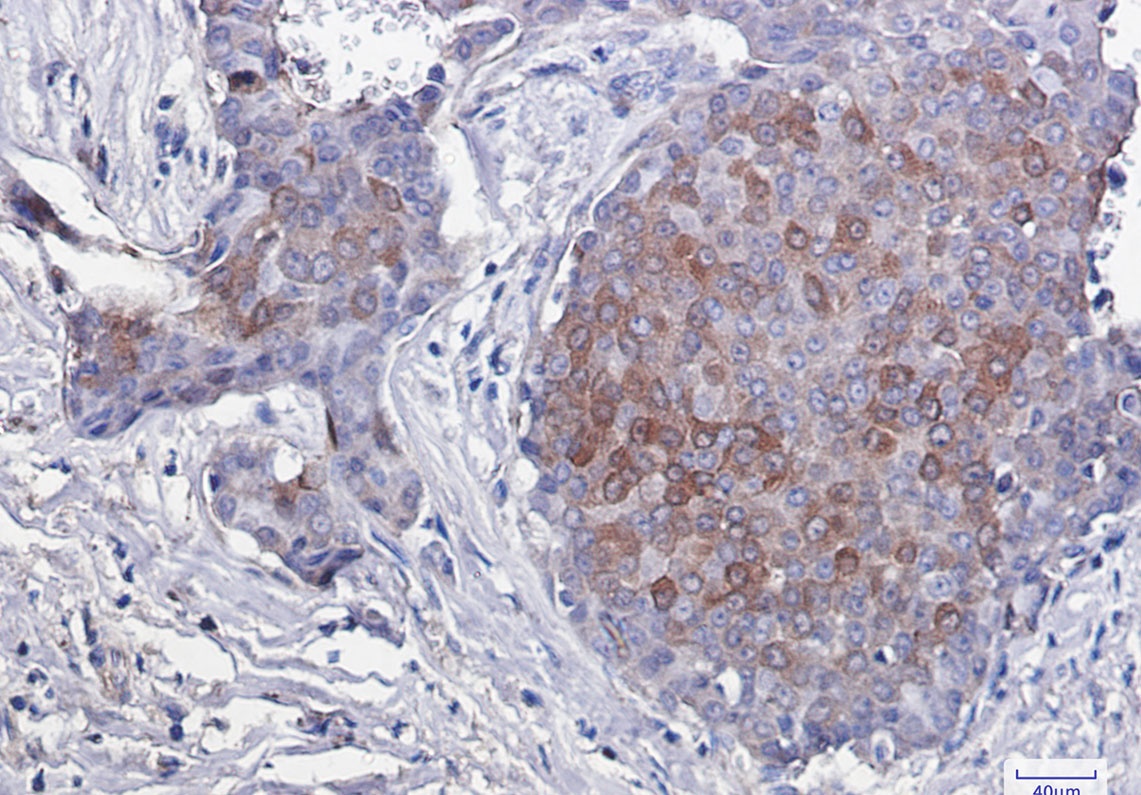 EIF4EBP1 Antibody