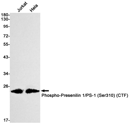PSEN1 Antibody