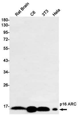 ARPC5 Antibody