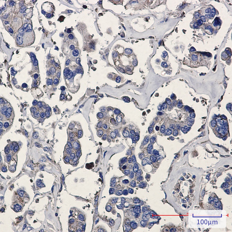 ARPC5 Antibody