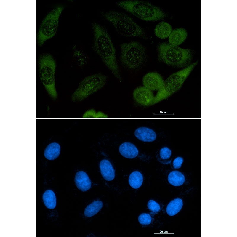 Profilin 1 Rabbit Monoclonal Antibody