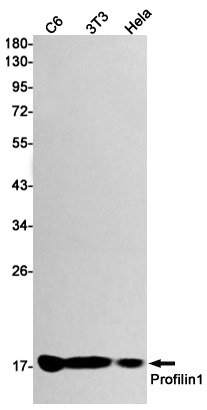 Profilin 1 Rabbit Monoclonal Antibody
