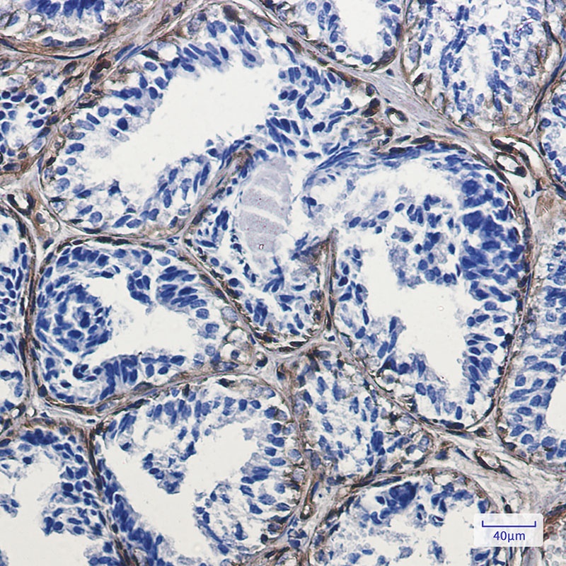 CAV1 Antibody