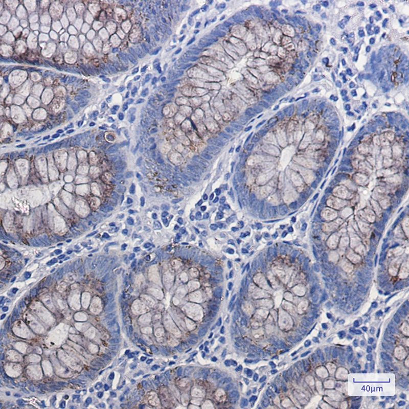 Anterior Gradient 2 Rabbit Monoclonal Antibody
