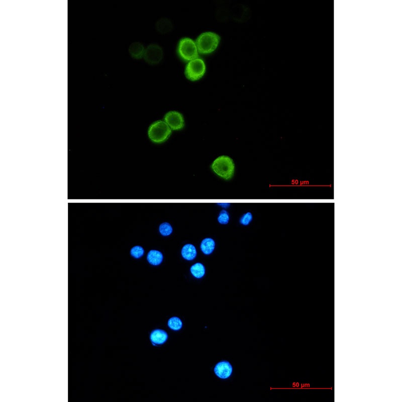 Anterior Gradient 2 Rabbit Monoclonal Antibody
