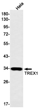 TREX1 Antibody