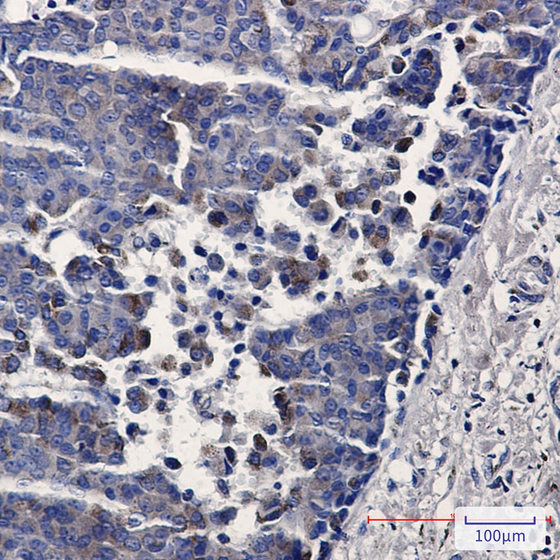 TREX1 Antibody
