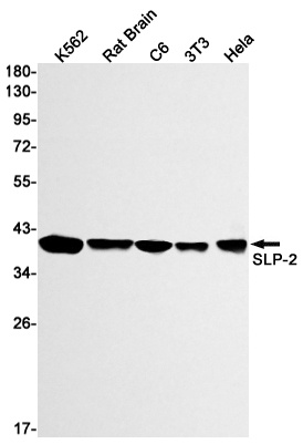 STOML2 Antibody