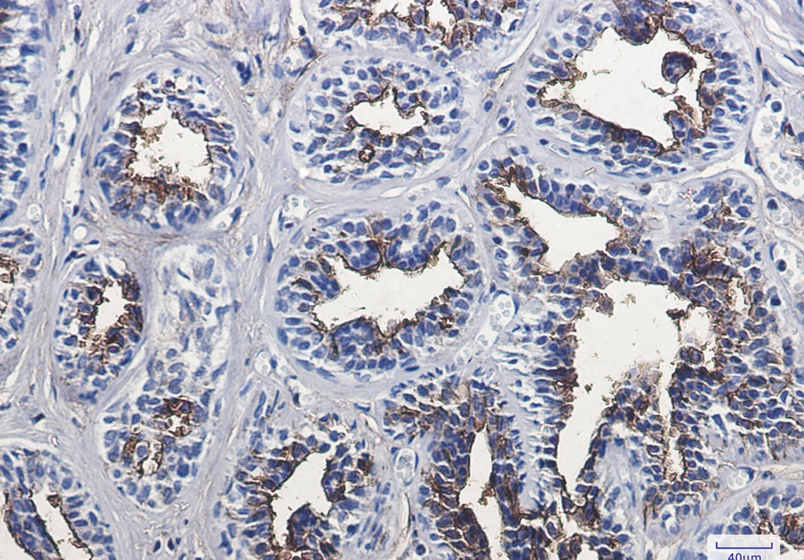 CD13 Rabbit Monoclonal Antibody