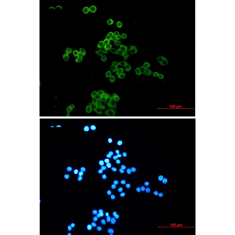 DSC3 Antibody