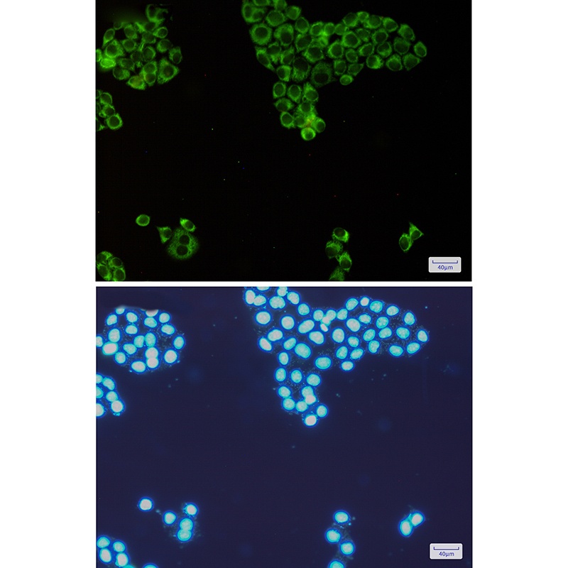 EIF2AK2 Antibody