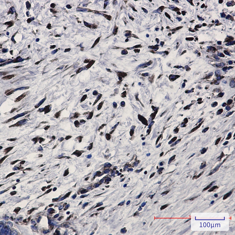 EIF2AK2 Antibody