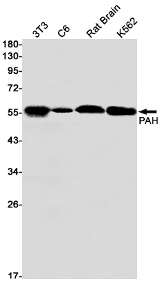 PAH Rabbit Monoclonal Antibody