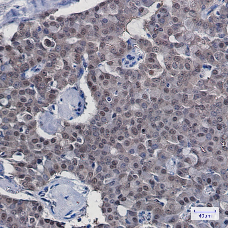 COPS8 Rabbit Monoclonal Antibody