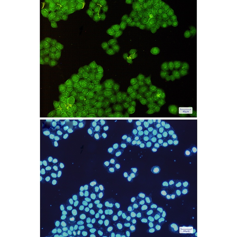 Annexin VI Rabbit Monoclonal Antibody