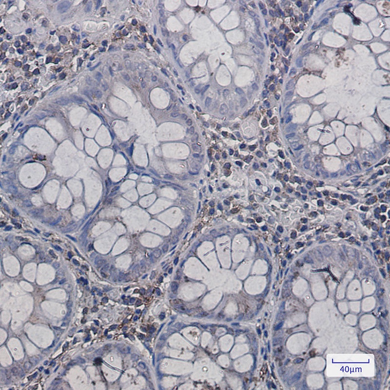 Annexin VI Rabbit Monoclonal Antibody