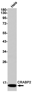 CRABP2 Antibody