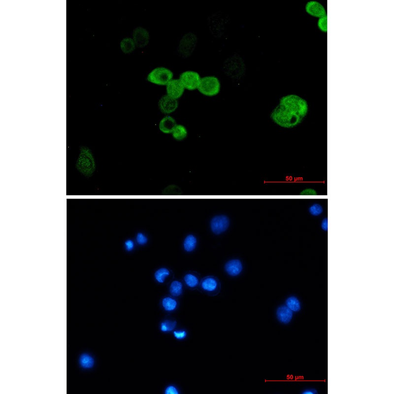 CRABP2 Antibody