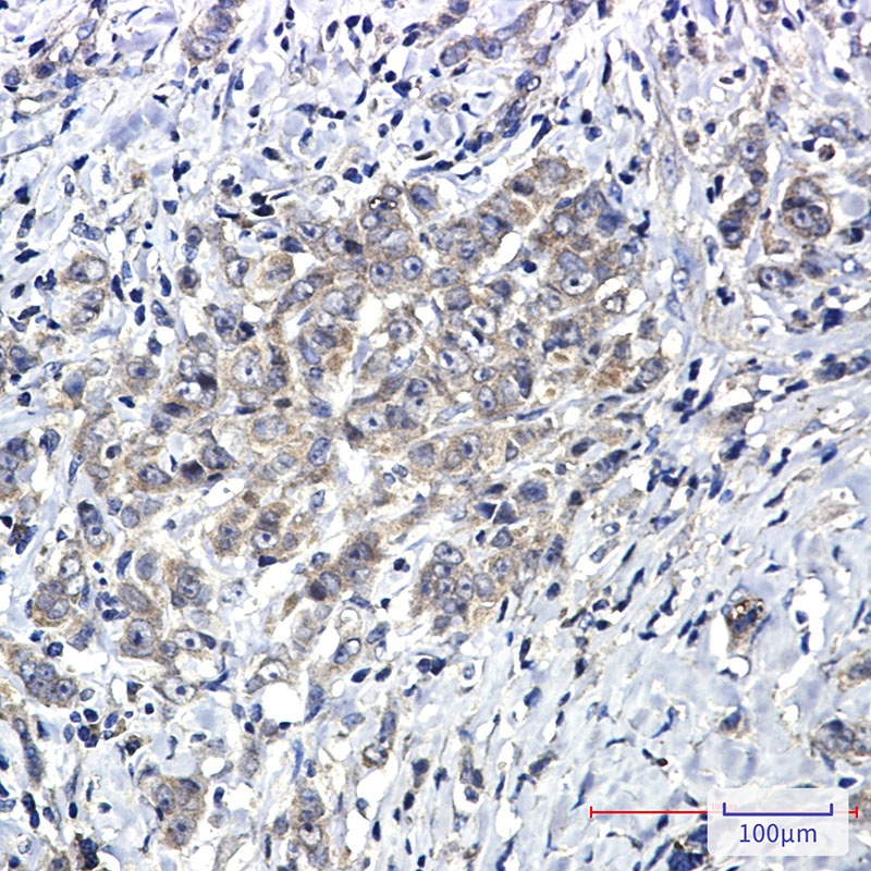 PTPN11 Antibody