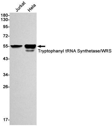 WARS1 Antibody