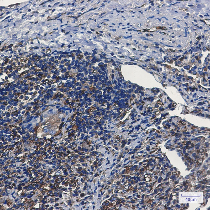 WARS1 Antibody