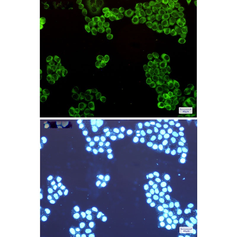 WARS1 Antibody
