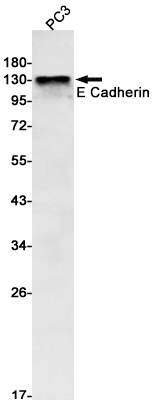CDH1 Antibody