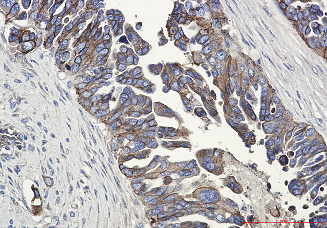 CDH1 Antibody