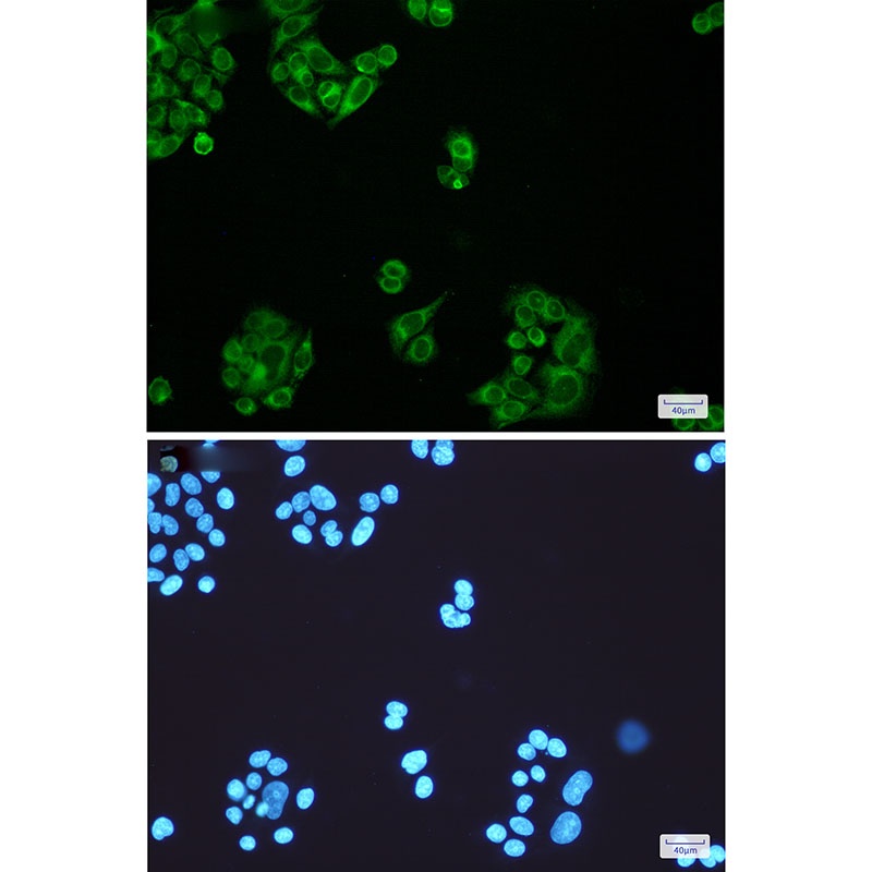 ELOVL5 Antibody