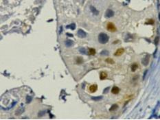 PCNA (9C9) Mouse mAb