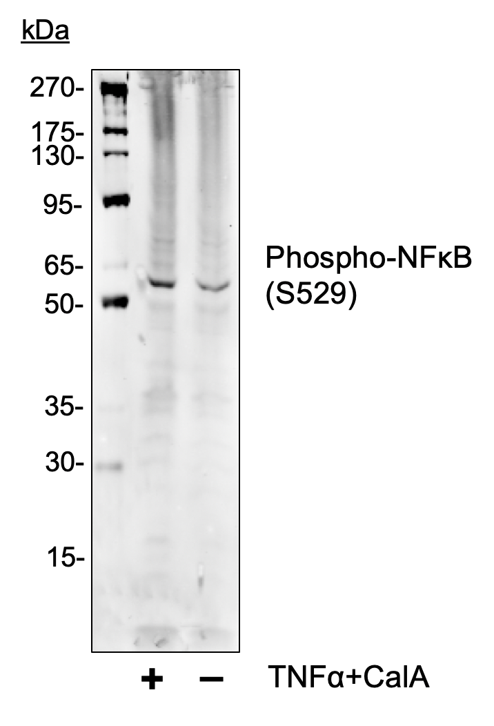 Phospho-NFkB p65 (Ser529) rabbit mAb Antibody