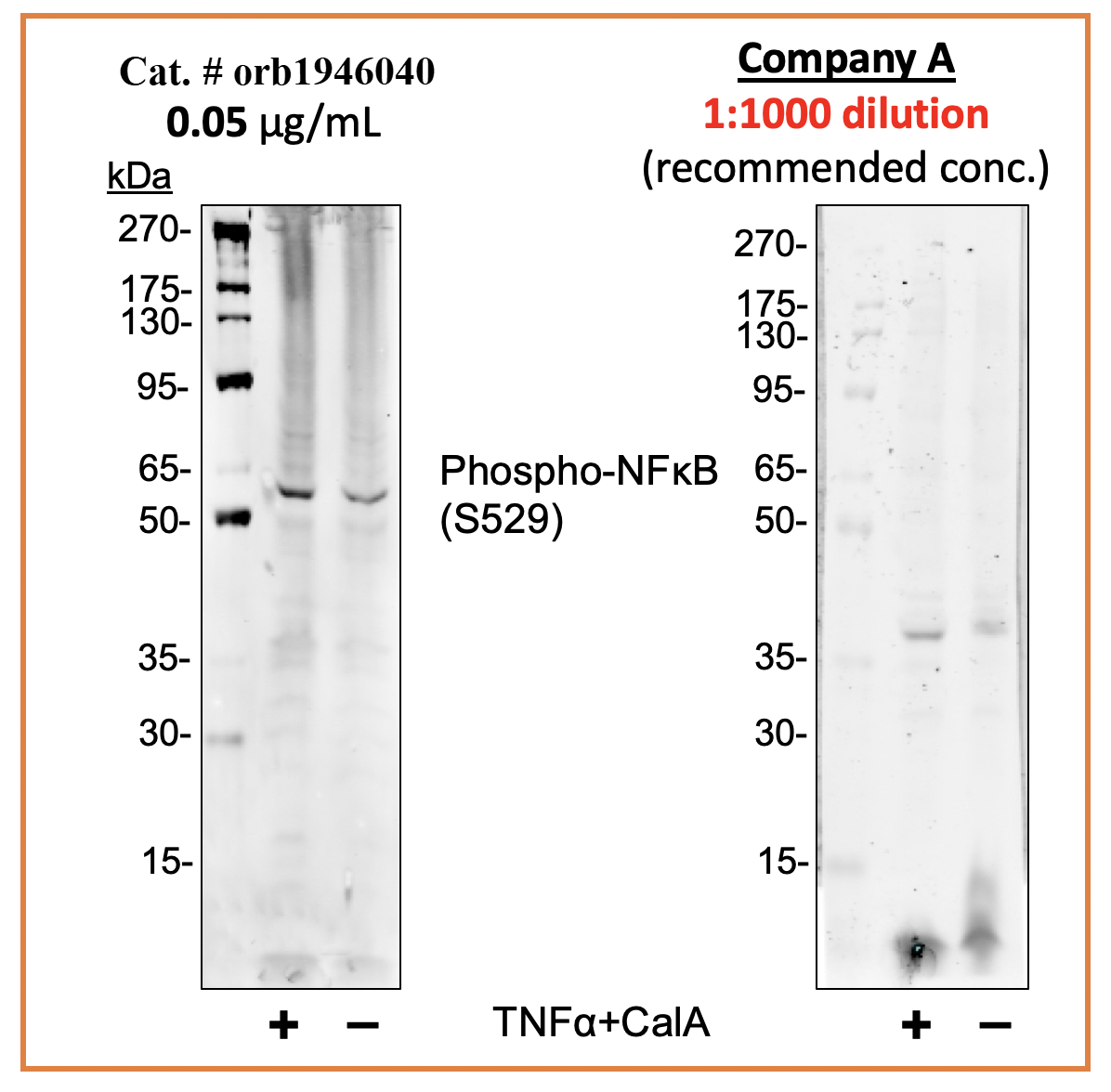 Phospho-NFkB p65 (Ser529) rabbit mAb Antibody
