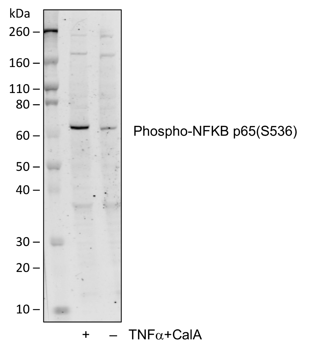 Phospho-NFKB p65 (Ser536) rabbit mAb Antibody