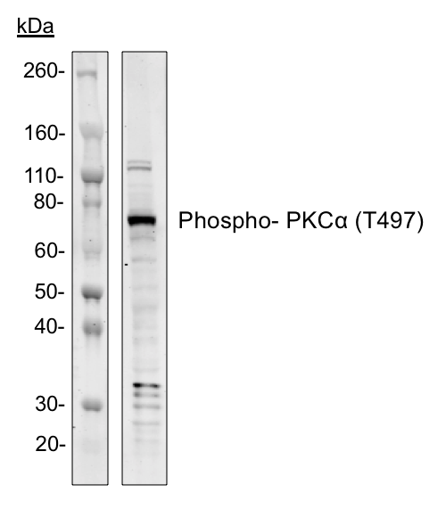Phospho-PKCa (Thr497) (F1) rabbit mAb Antibody