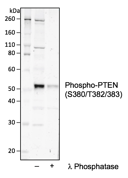 Phospho-PTEN (Ser380/Thr382/383) (E4) rabbit mAb Antibody