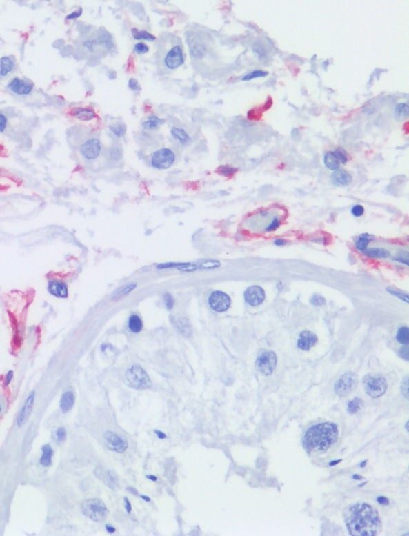CD271 Antibody