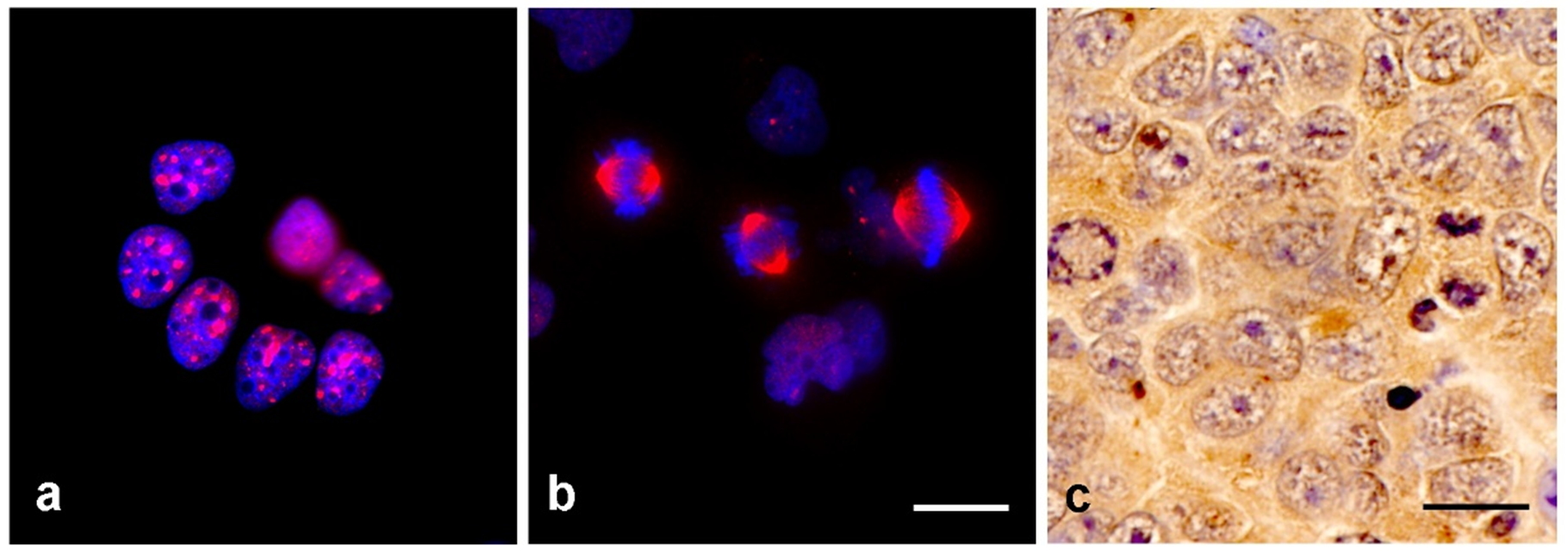 TPX2 Antibody